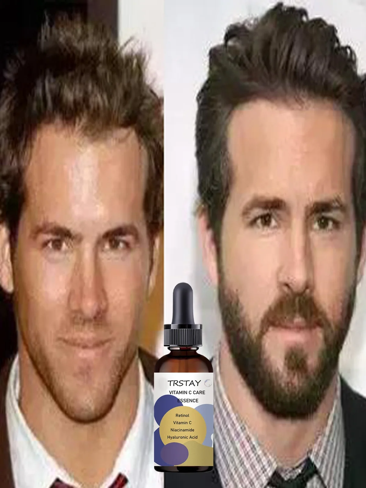 Top Beard Oils for Men That Boost Growth and Enhance Texture Naturally