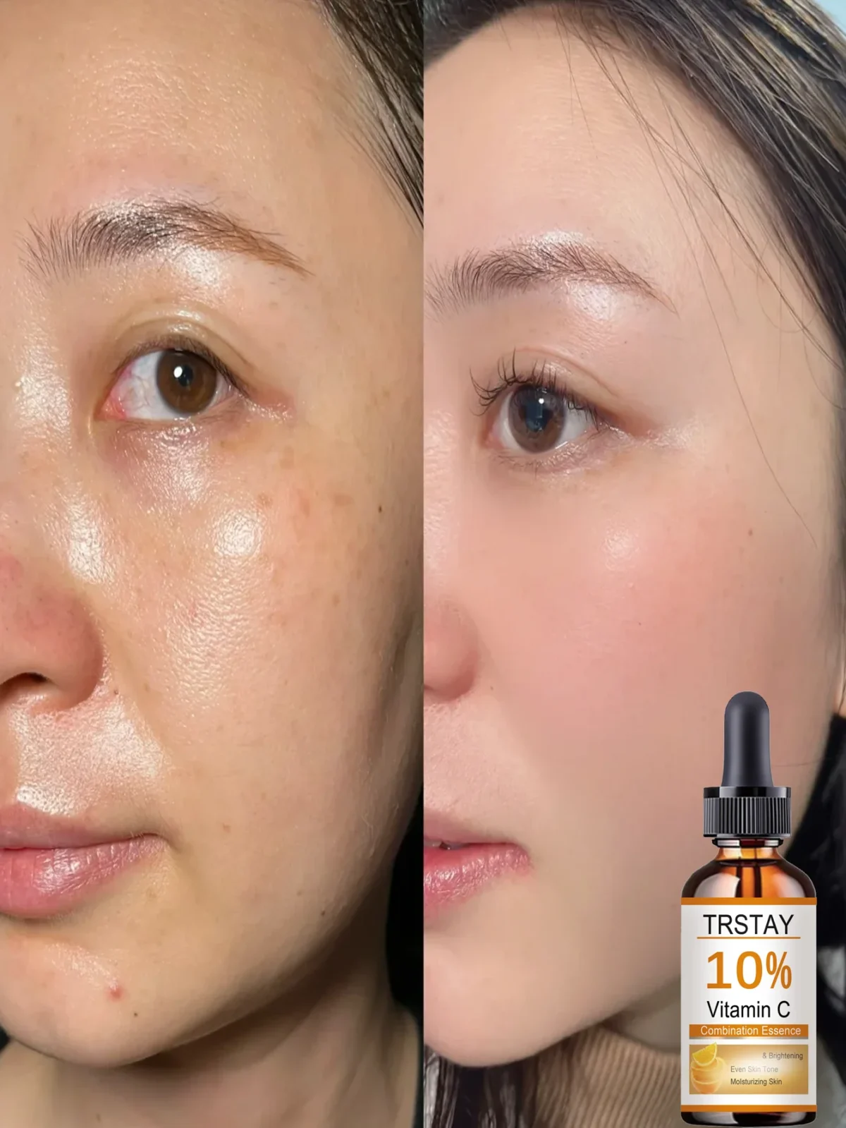 Top Benefits of This Alcohol-Free Facial Oil for Sensitive Skin Hydration